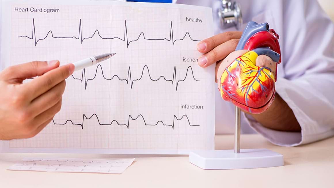 Electrocardiograma - EKG: ce este? Tipuri si rolul acestora
